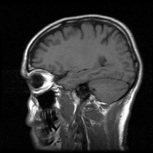 1mri-head-scan-370098-m.jpg